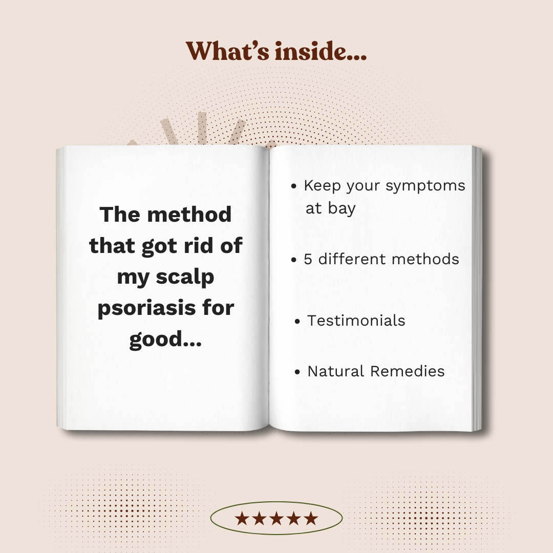 Psoriasis relief guide