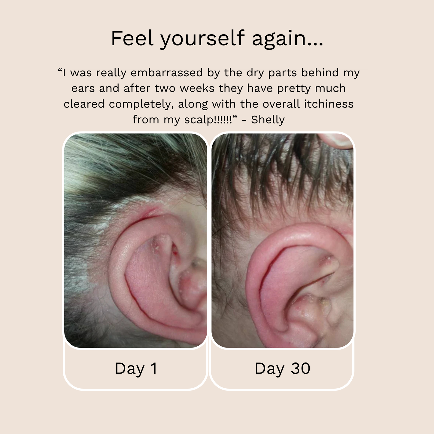 Scalp Scrub