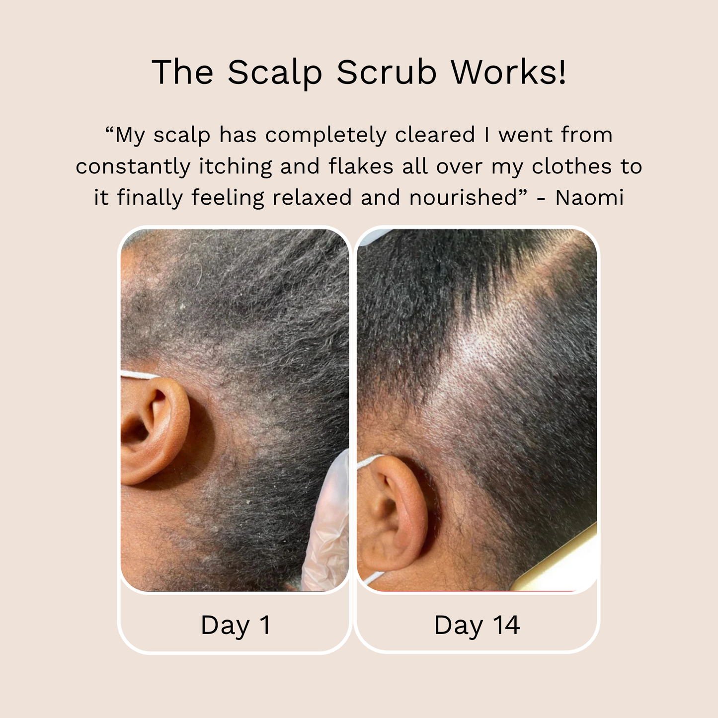 Scalp Scrub