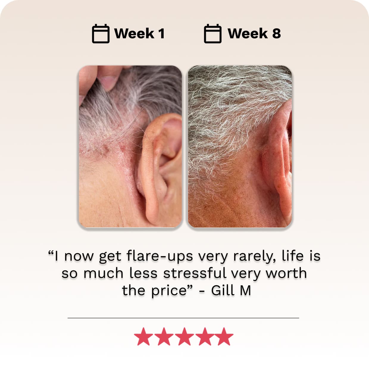 Scalp Scrub