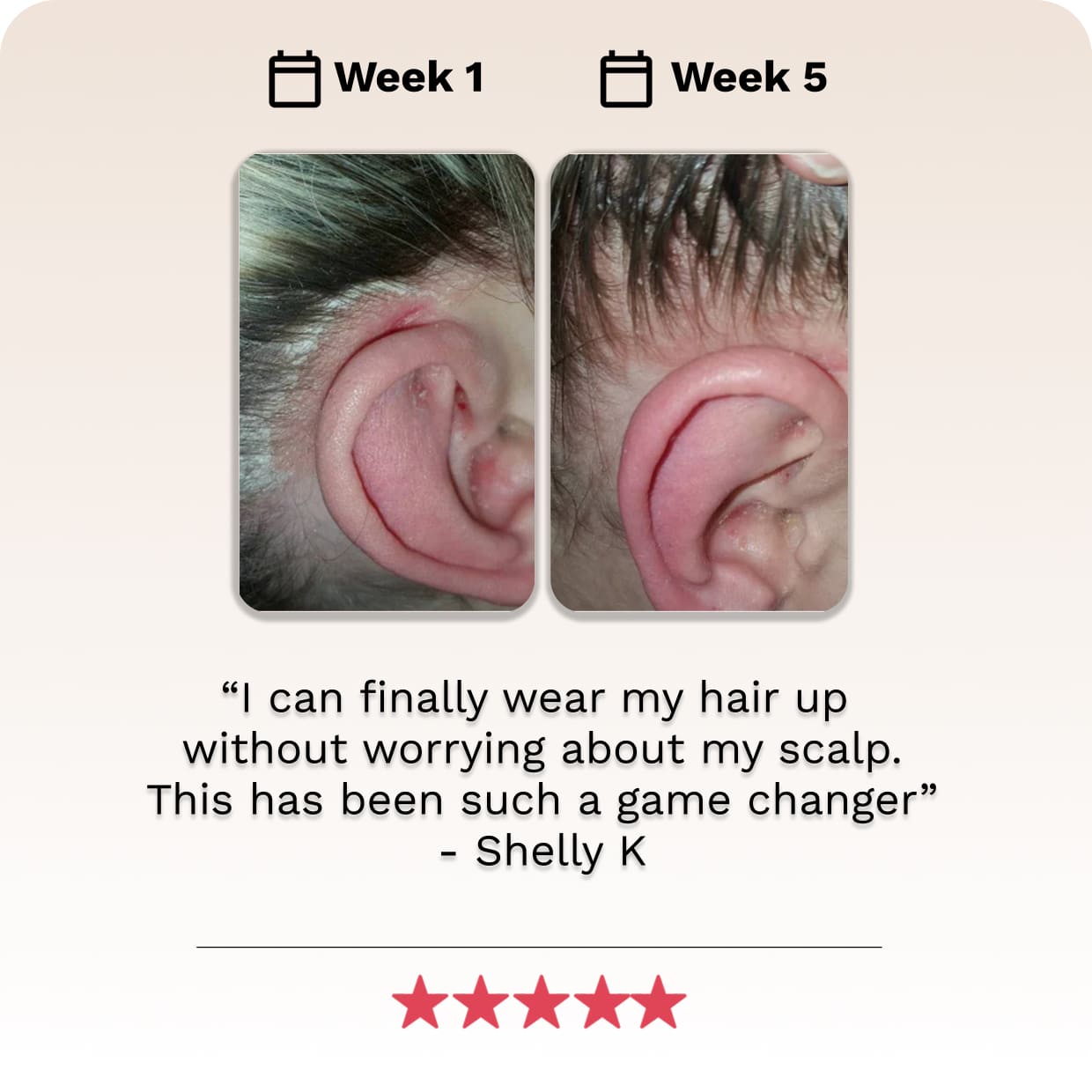 Scalp Scrub